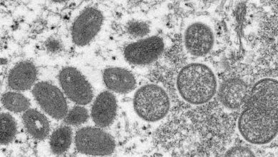 Photo of Ministério da Saúde confirma sétimo caso de varíola dos macacos no país