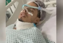 Photo of Homem passa 4 dias na UTI após tirar dente do siso com aluna da universidade