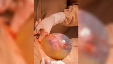 Photo of Mãe dá à luz bebê em parto considerado raro; fato ocorreu no Centro Norte baiano