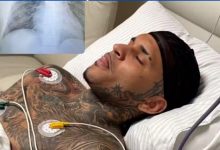 Photo of “Eu sou um milagre”: cantor Anderson Neiff desabafa após ser baleado em ataque após show