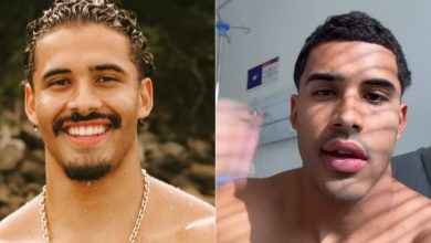 Photo of Cantor Nilo Froelich cancela shows após diagnostico de ‘paralisia de Bell’