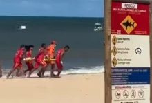 Photo of Vítimas de ataques de tubarão em Pernambuco deixam UTI após amputações
