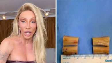 Photo of Maya Massafera revela o resultado da cirurgia de redução dos ombros